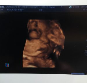 妊娠9か月 エコー写真赤ちゃん