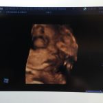 妊娠9か月 エコー写真赤ちゃん